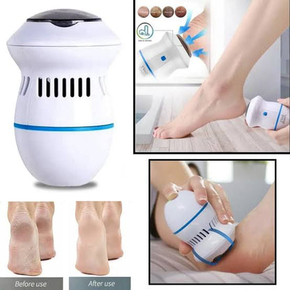 Electric Callus Remover